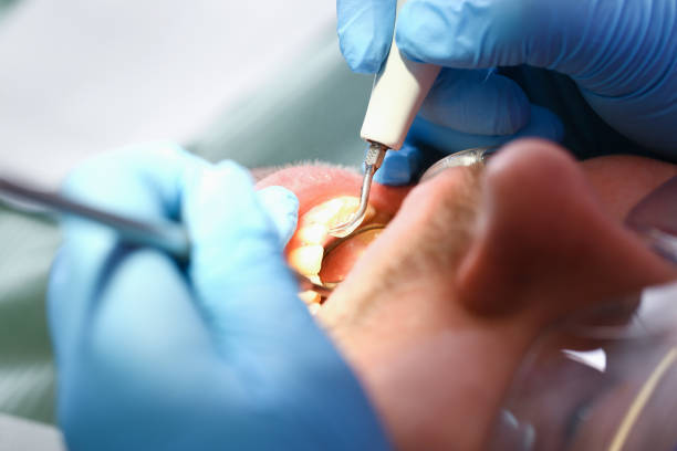 Best Broken or Chipped Tooth Repair in Pine Grove, PA